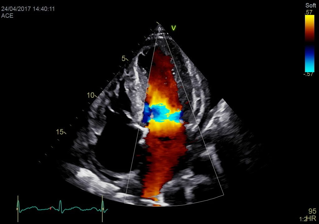 ЦДК, датчик M5Sc-D XDсlear