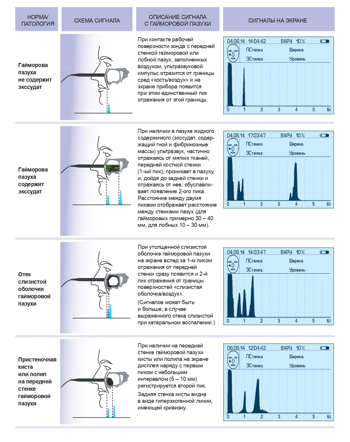 Ангиодин-Эхо/П-Лор - изображение №2