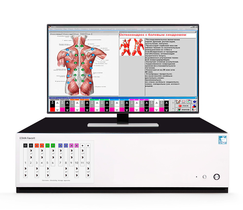 ЭСМА 12.48 Фаворит