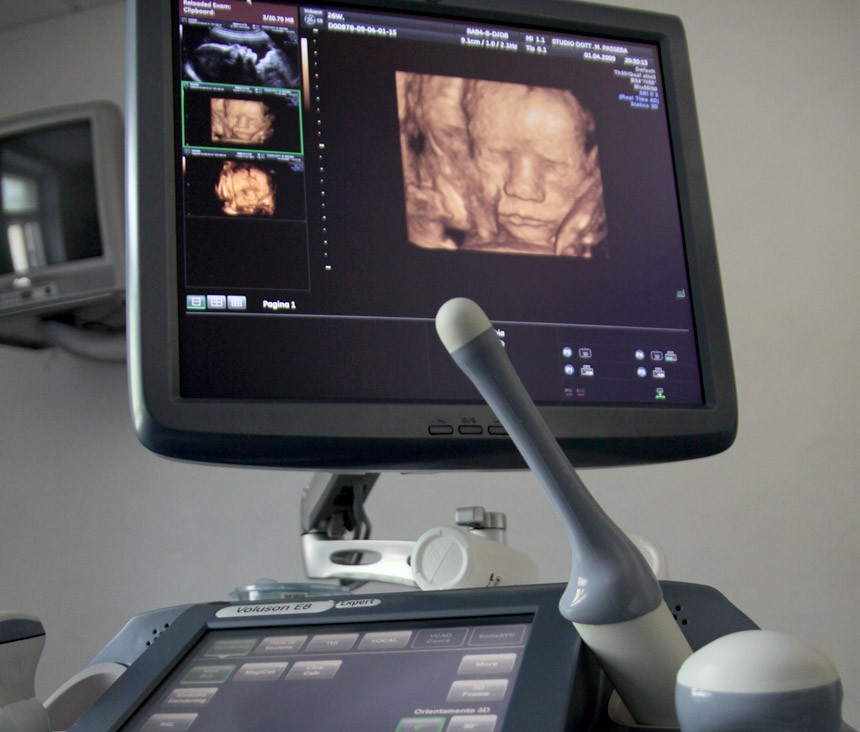 GE Voluson E8 BT13 - изображение №3