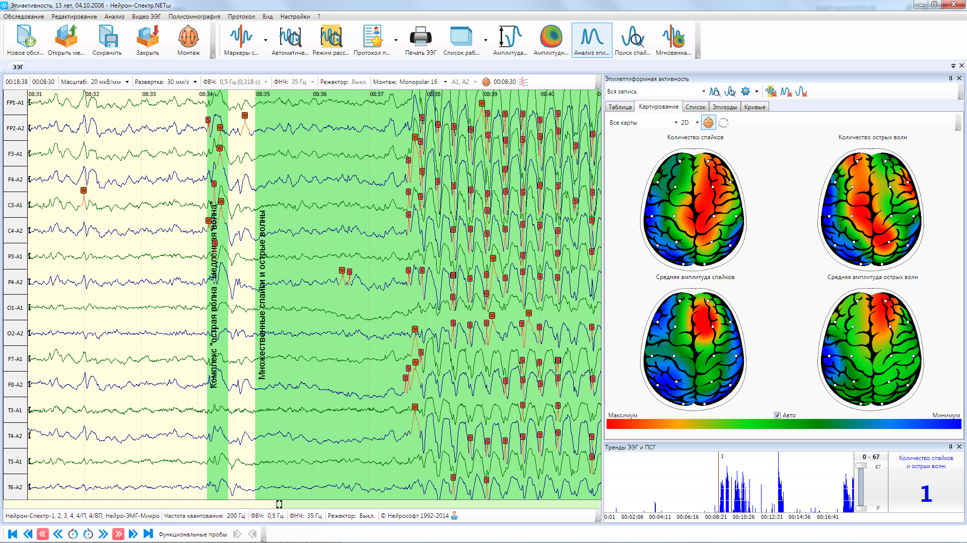 НЕЙРОН-СПЕКТР-5 - изображение №7