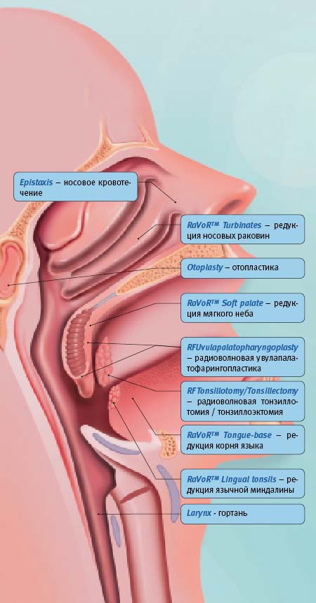 Sutter CURIS - изображение №7
