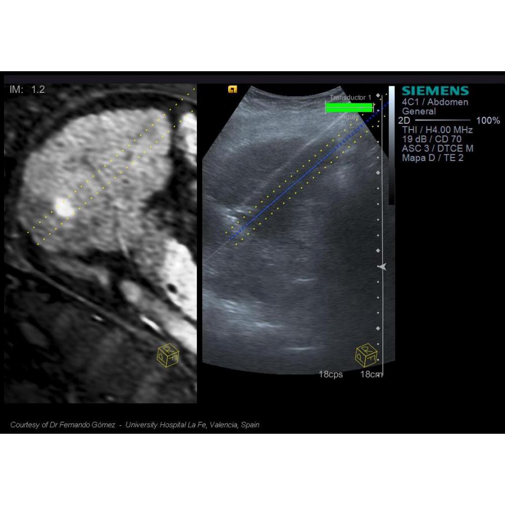 Siemens ACUSON S3000 - изображение №8