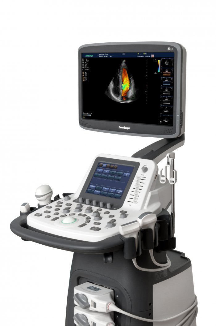 SonoScape S20Exp - Высокий класс - изображение №4