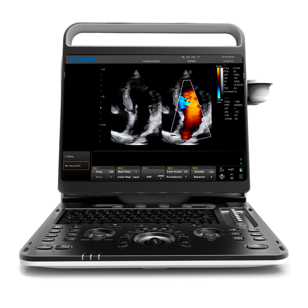 Chison SonoTouch 60 (EBit 60)