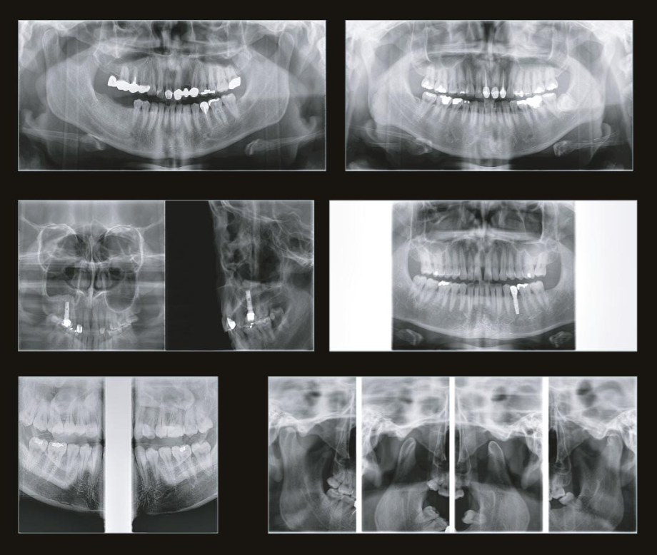 GENORAY Volux с цефалостатом - изображение №6