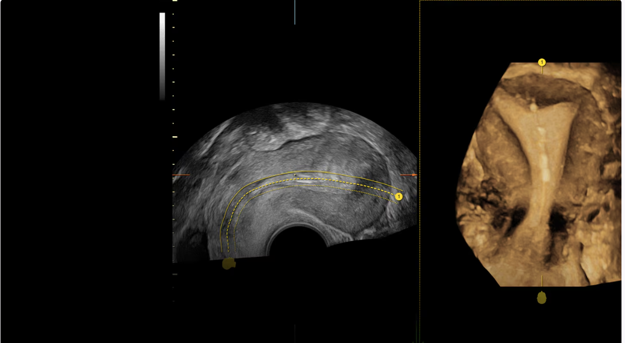 Объемная визуализация