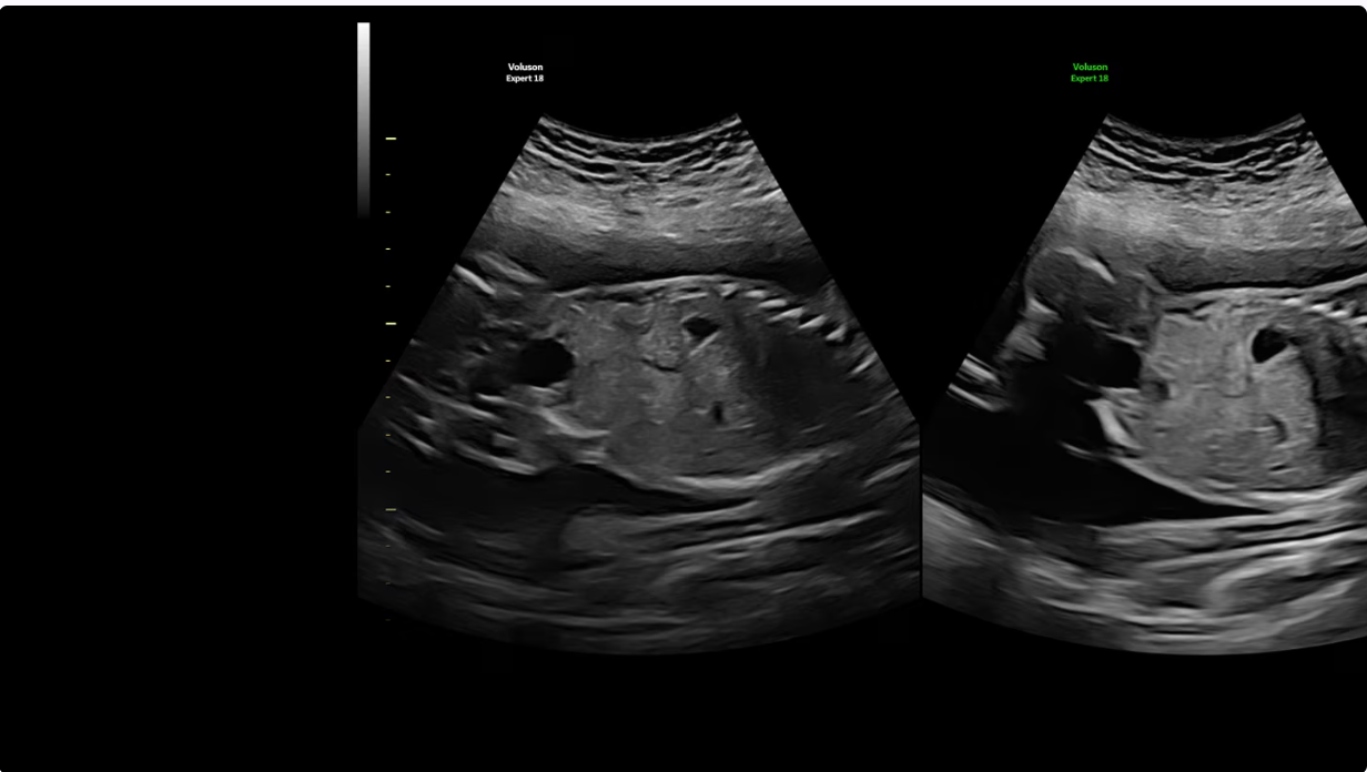 Сложные экземы