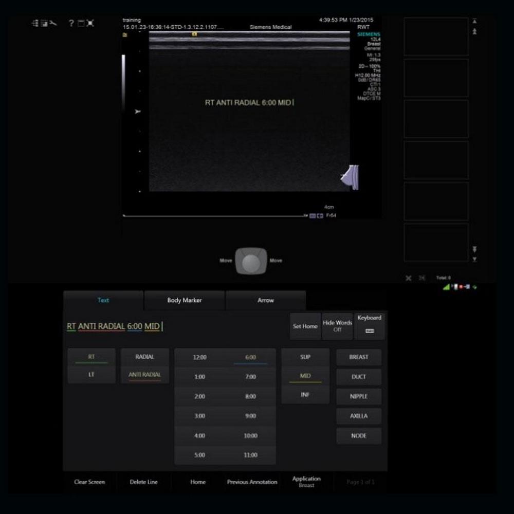 Siemens ACUSON S3000 - изображение №10