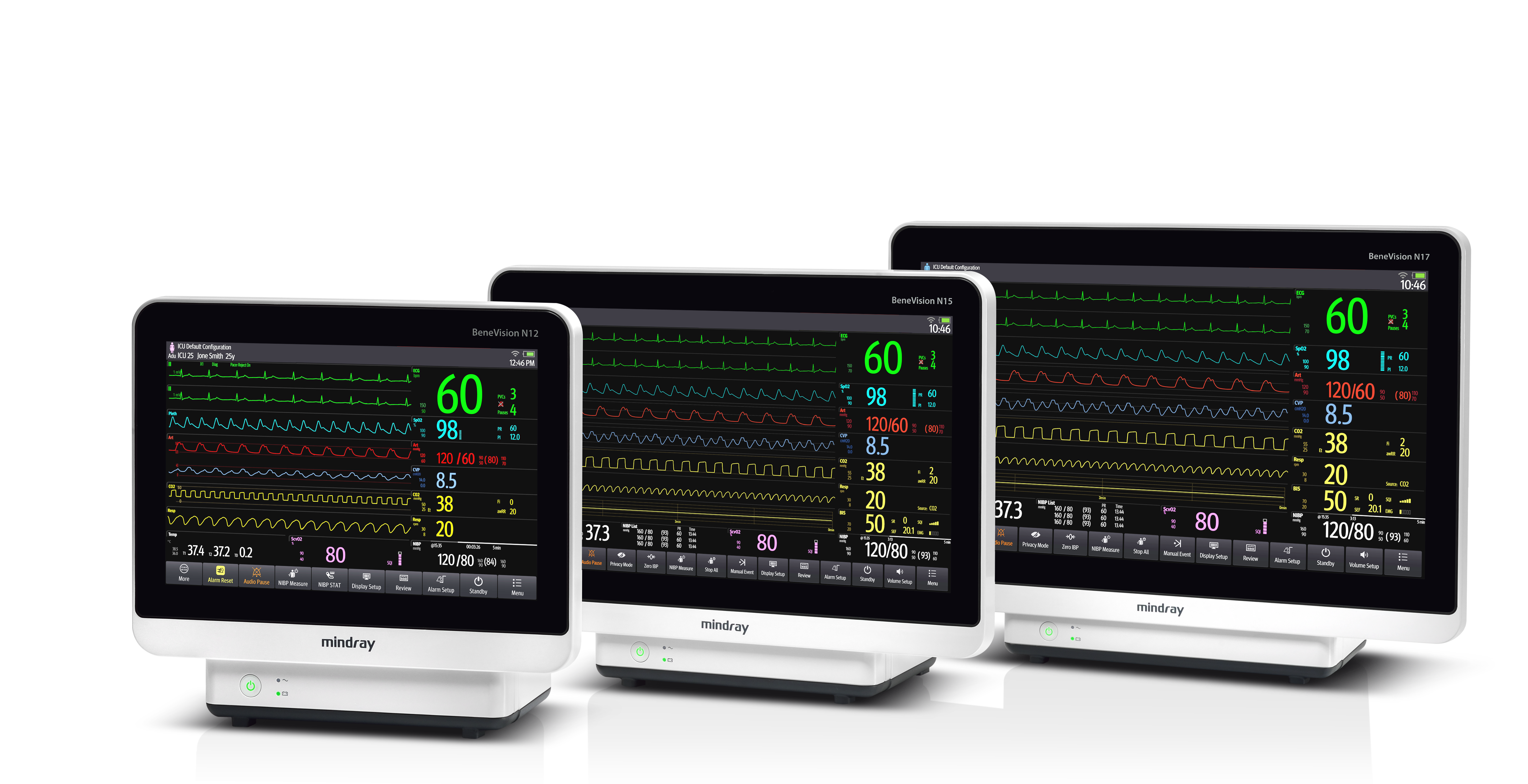 Mindray BeneVision серия - изображение №3