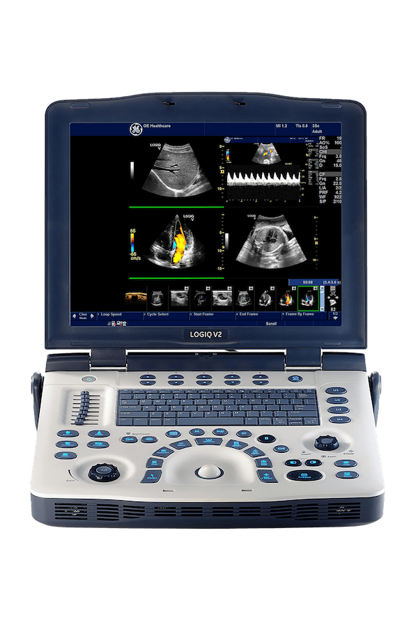 GE LOGIQ V2 - изображение №2