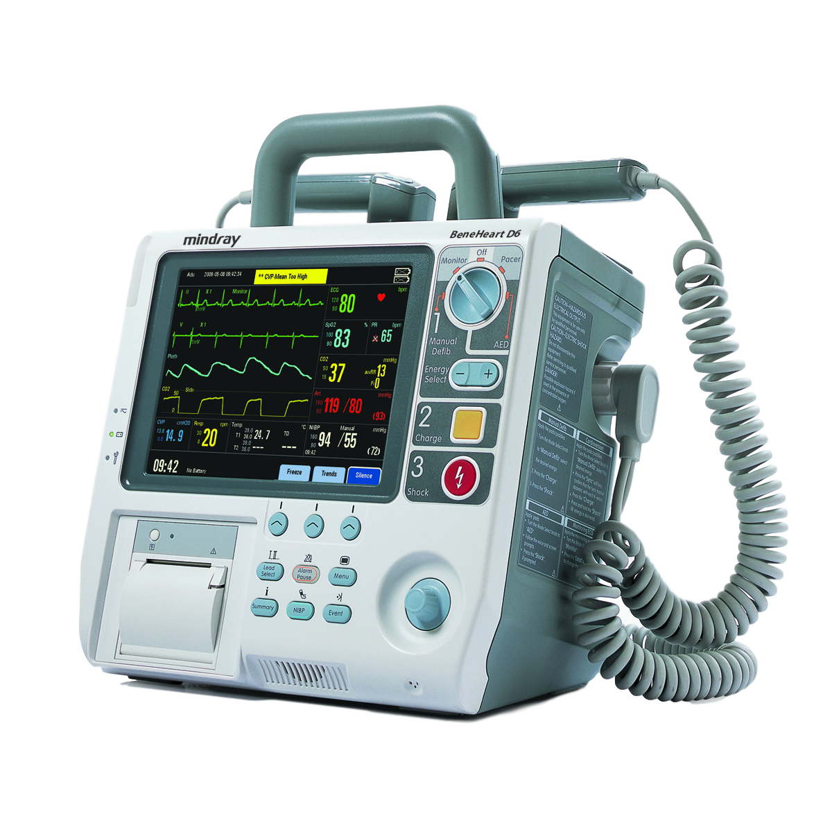 Mindray BeneHeart D6 - изображение №2