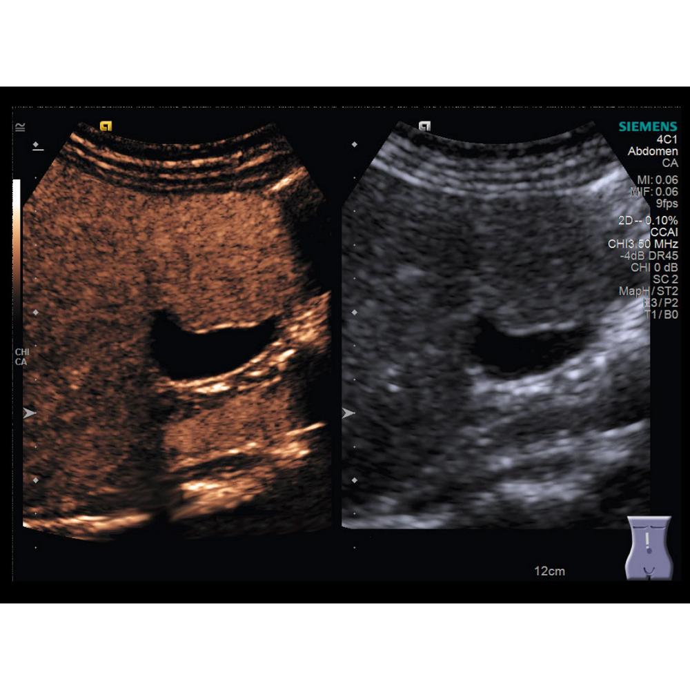 Siemens ACUSON S3000 - изображение №6