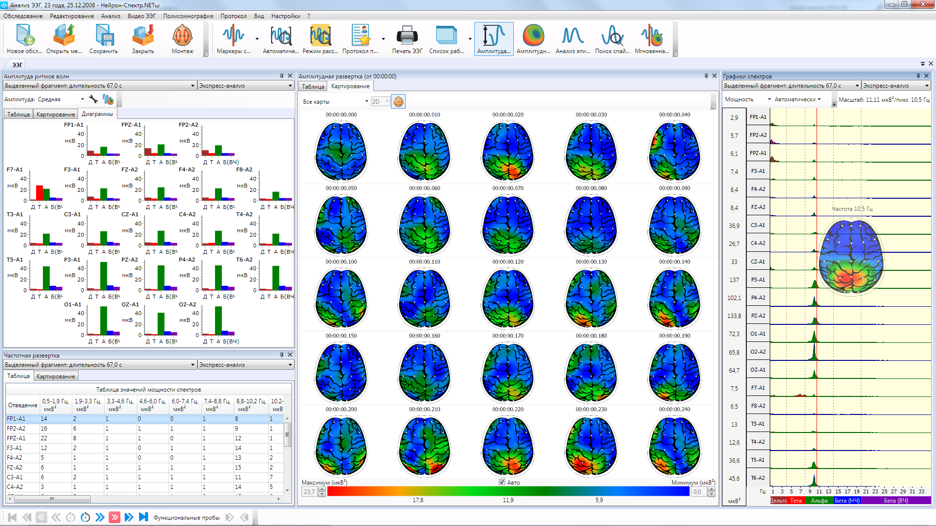 НЕЙРОН-СПЕКТР-1 - изображение №10