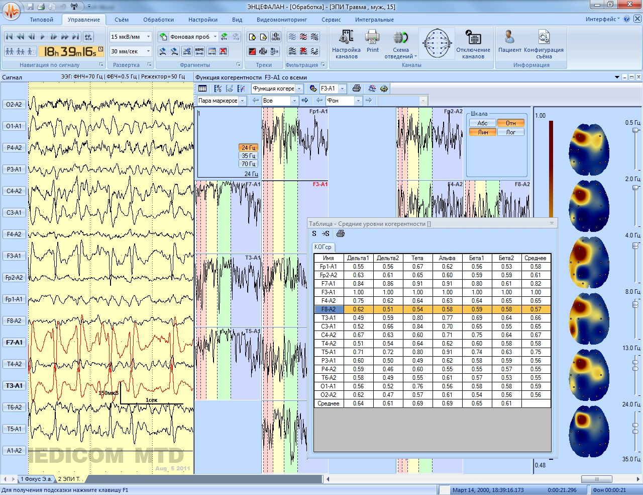 Энцефалан-ЭЭГР-19/26. Основная модификация - изображение №8