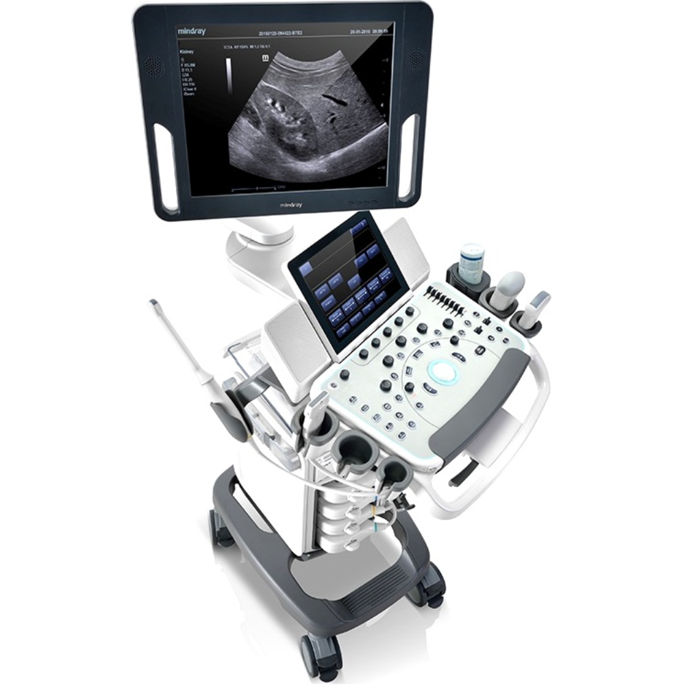 Mindray DC-55 - изображение №2