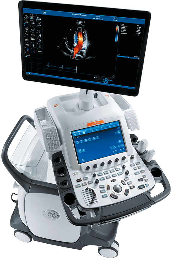 GE Vivid E90 - изображение №3