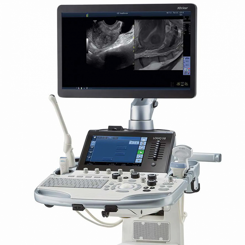 GE Logiq P8 - изображение №2