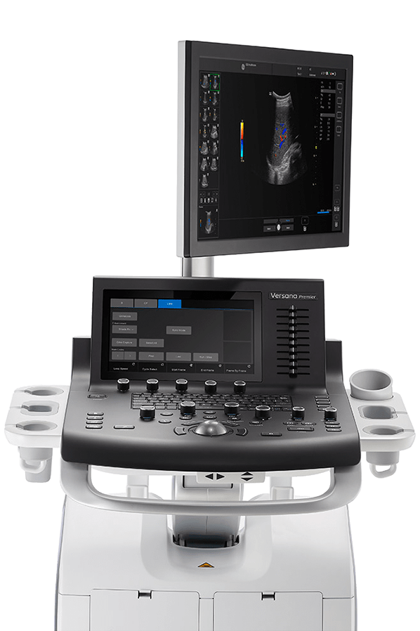 GE Versana Premier Black - изображение №3