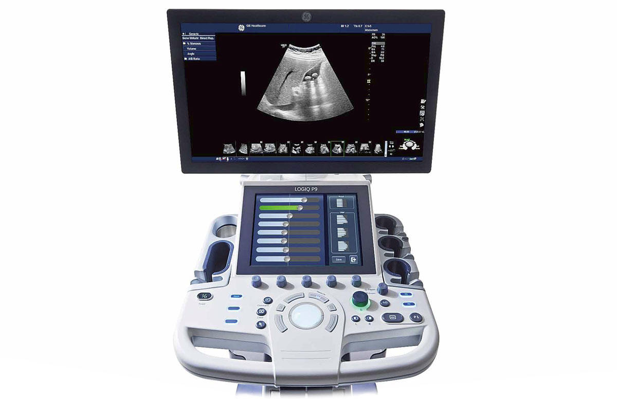 GE LOGIQ P9 - изображение №3