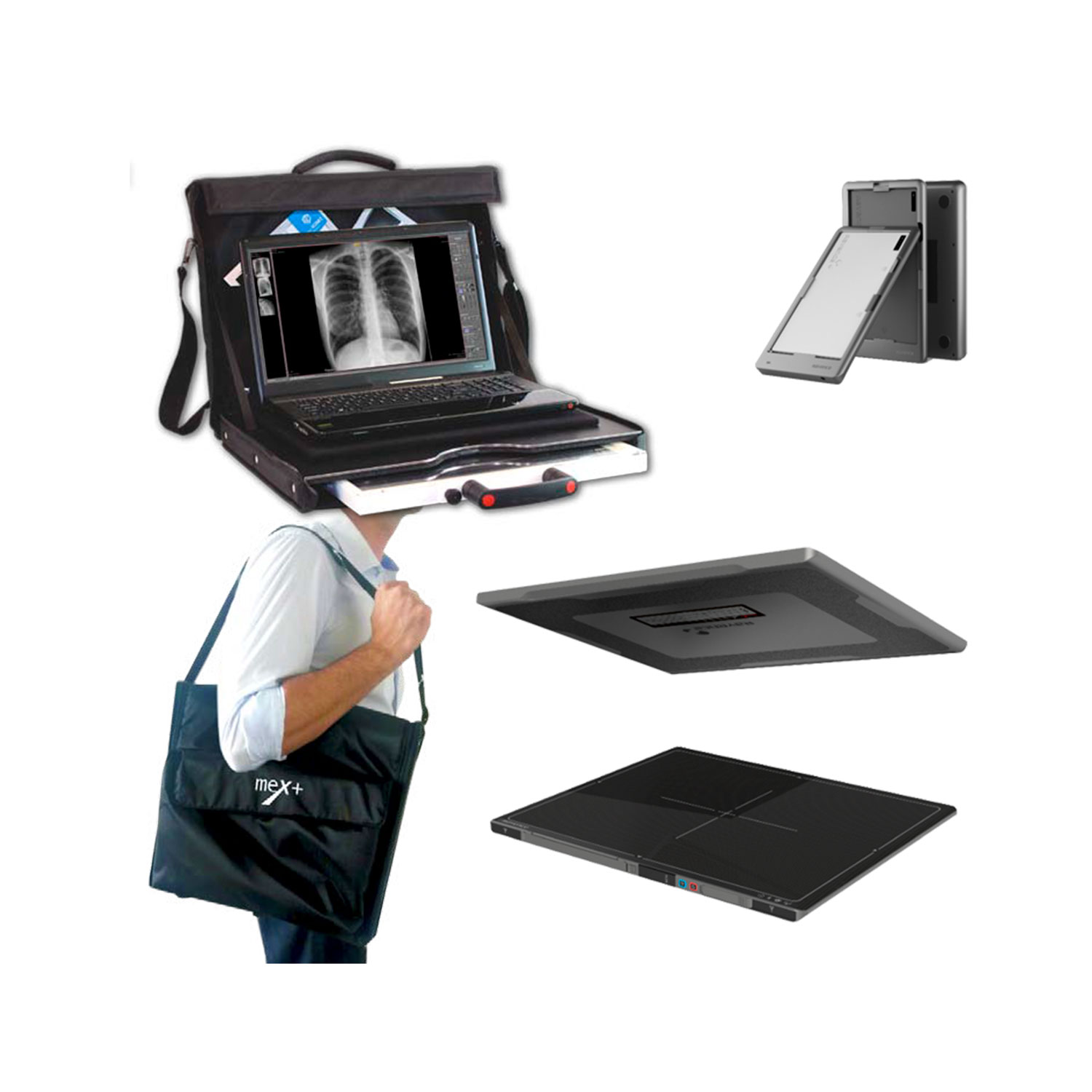 Комплект для лучевой диагностики в полевых условиях - изображение №4