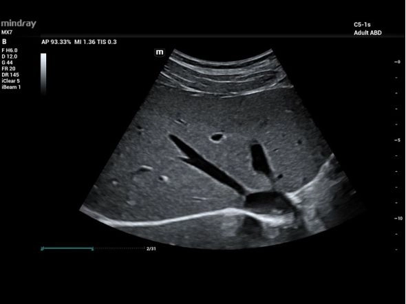 Абдоминальные исследования с контрастом