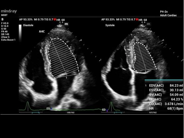 Сердечный цикл