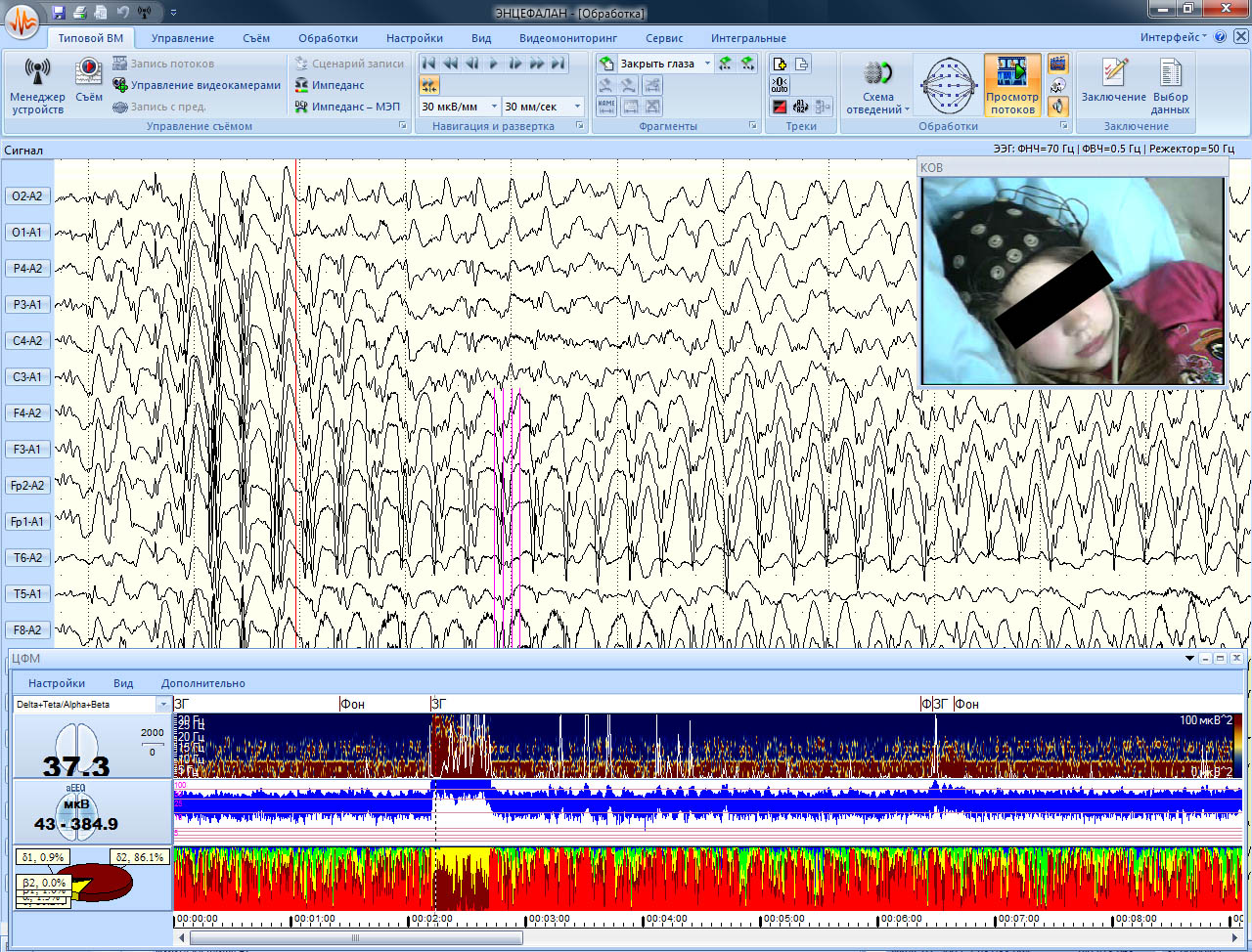 Энцефалан-Видео - изображение №9