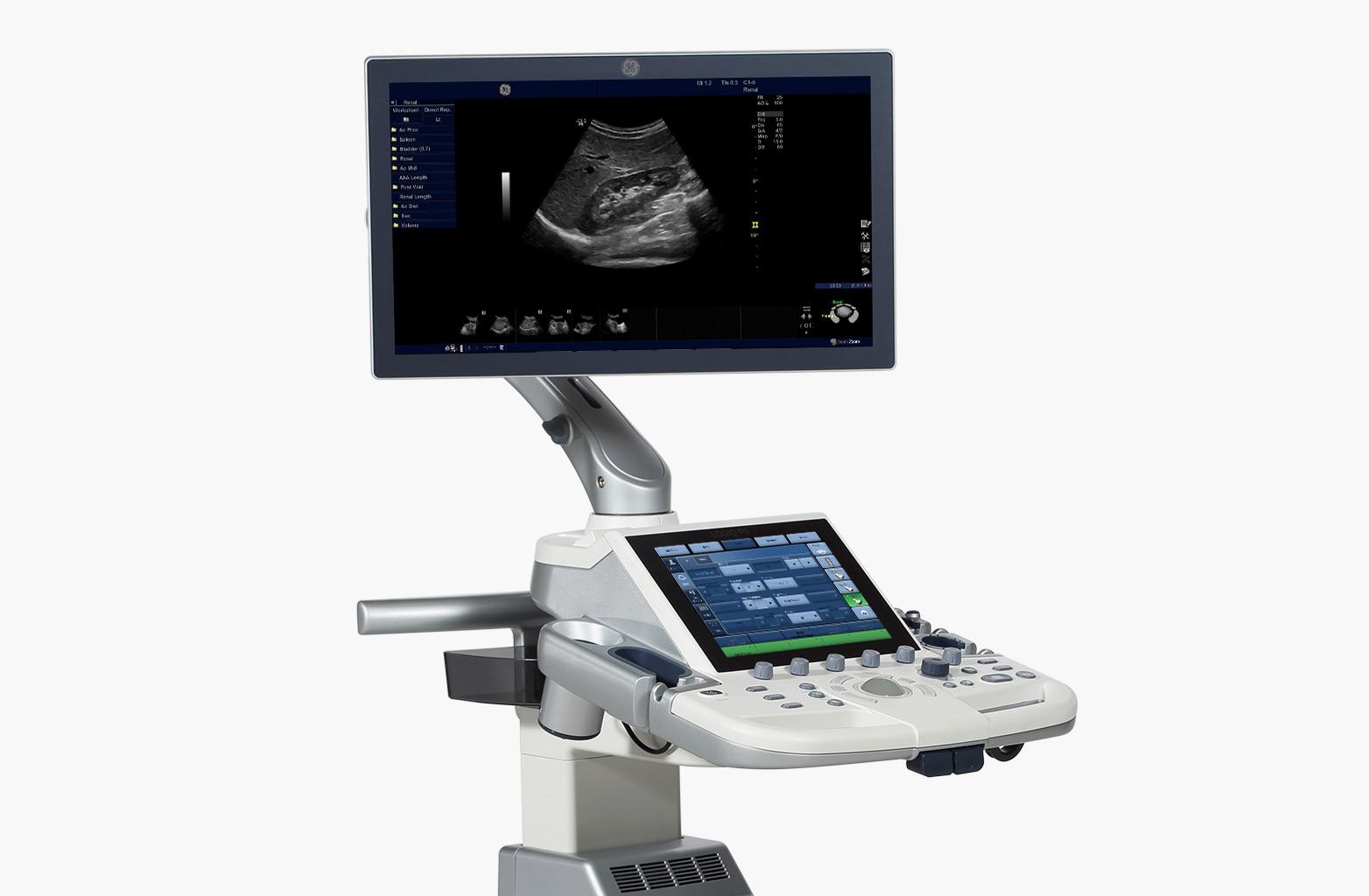 GE LOGIQ P9 - изображение №2