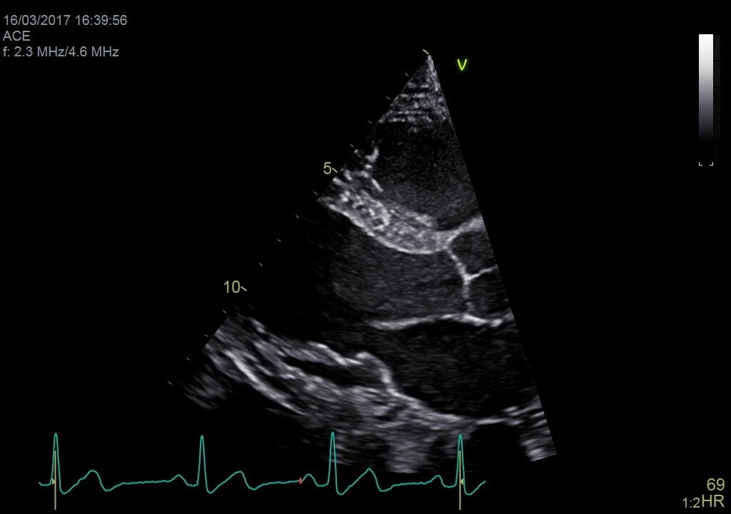 Текстура, датчик M5Sc-D XDсlear