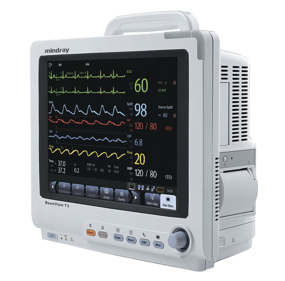 Mindray BeneView серия - изображение №3