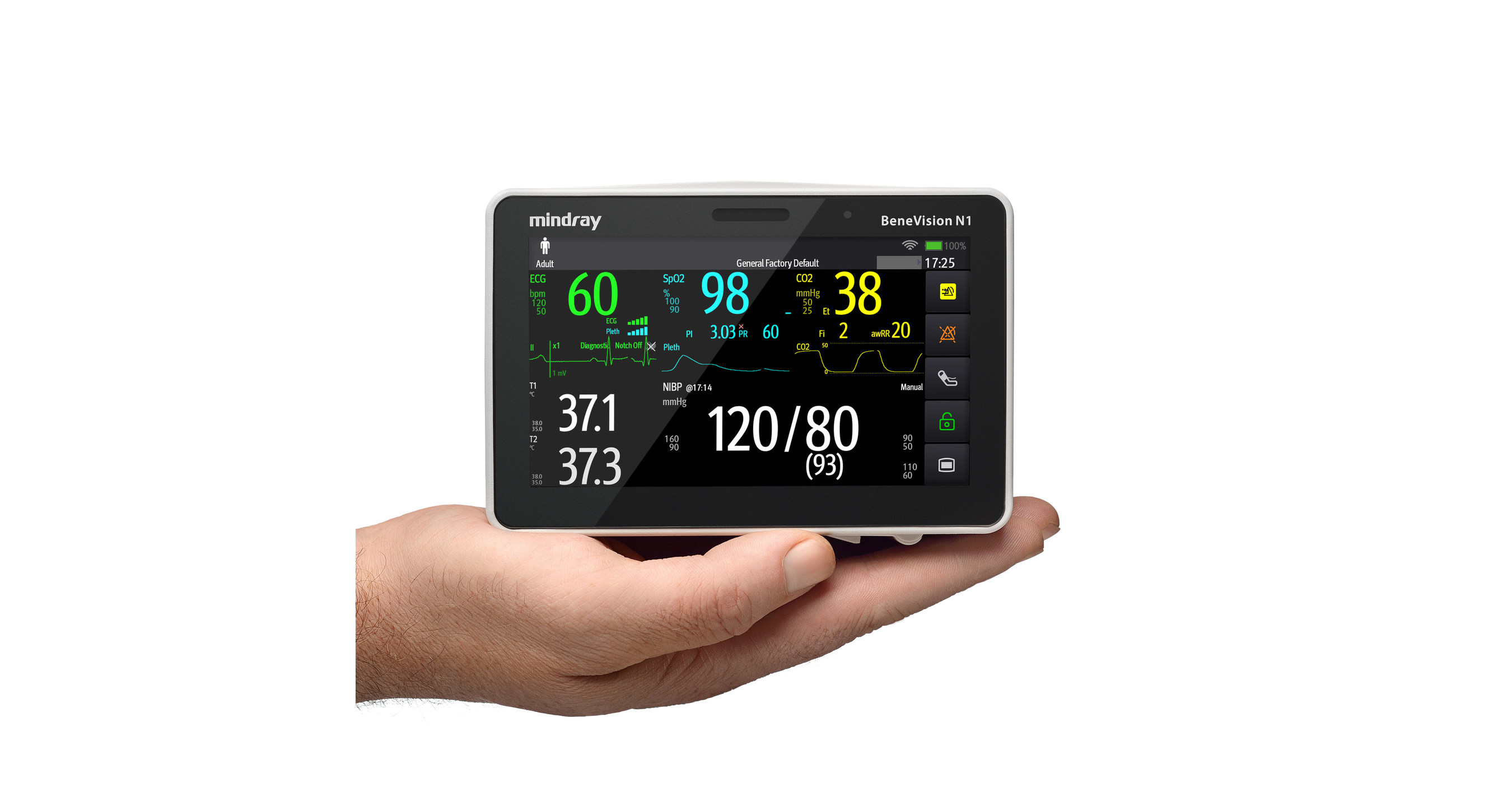 Mindray BeneVision серия - изображение №4