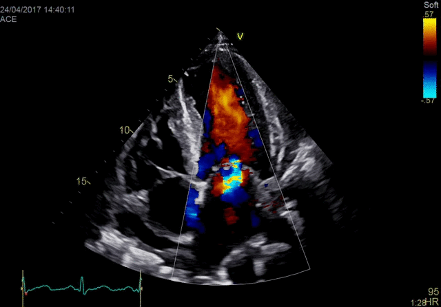 Технология датчика XDclear обеспечивает отличную цветовую чувствительность, контрастное разрешение и спектральную четкость