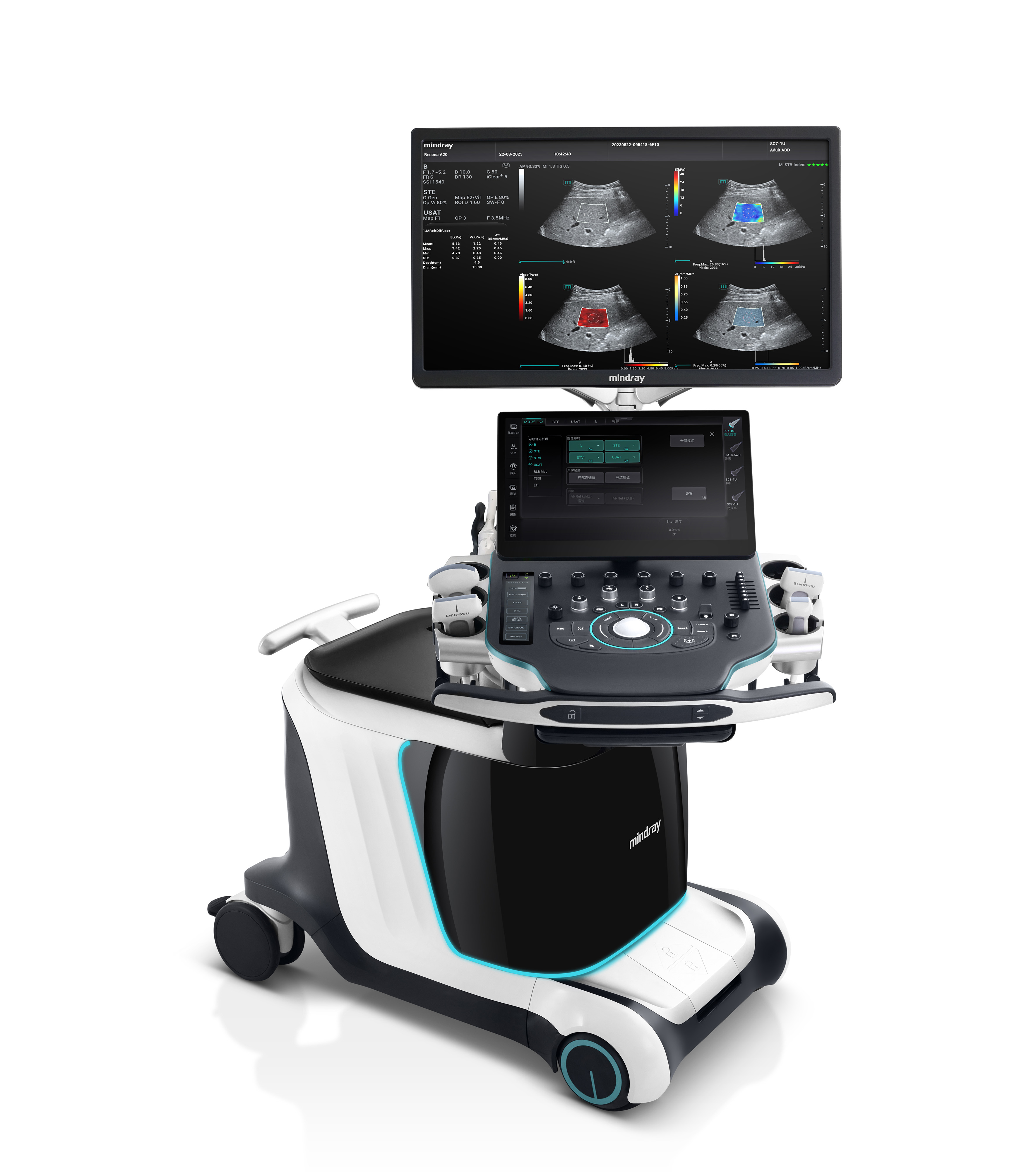 Mindray Resona A20 - изображение №3