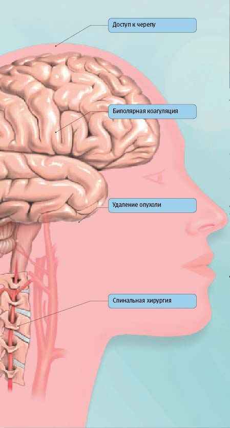 Sutter CURIS - изображение №6