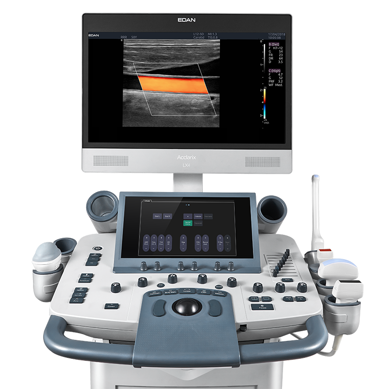 Edan Acclarix LX4 - изображение №3