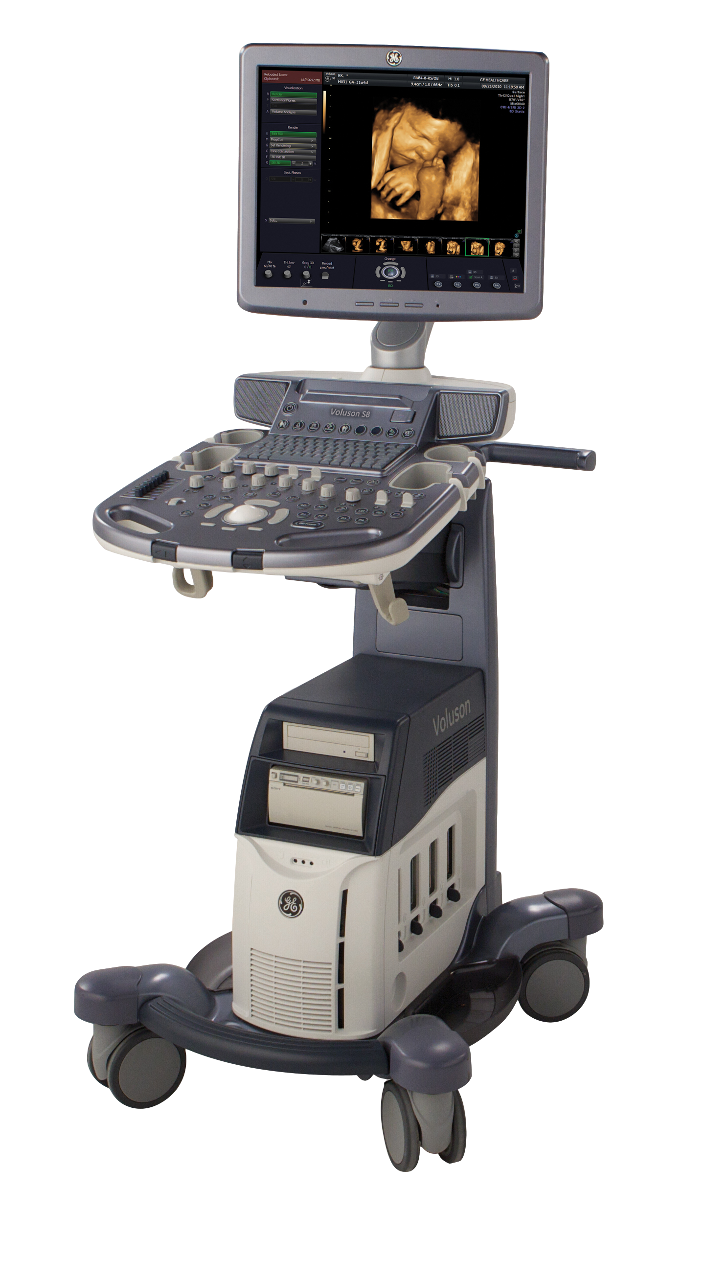 GE Voluson S6