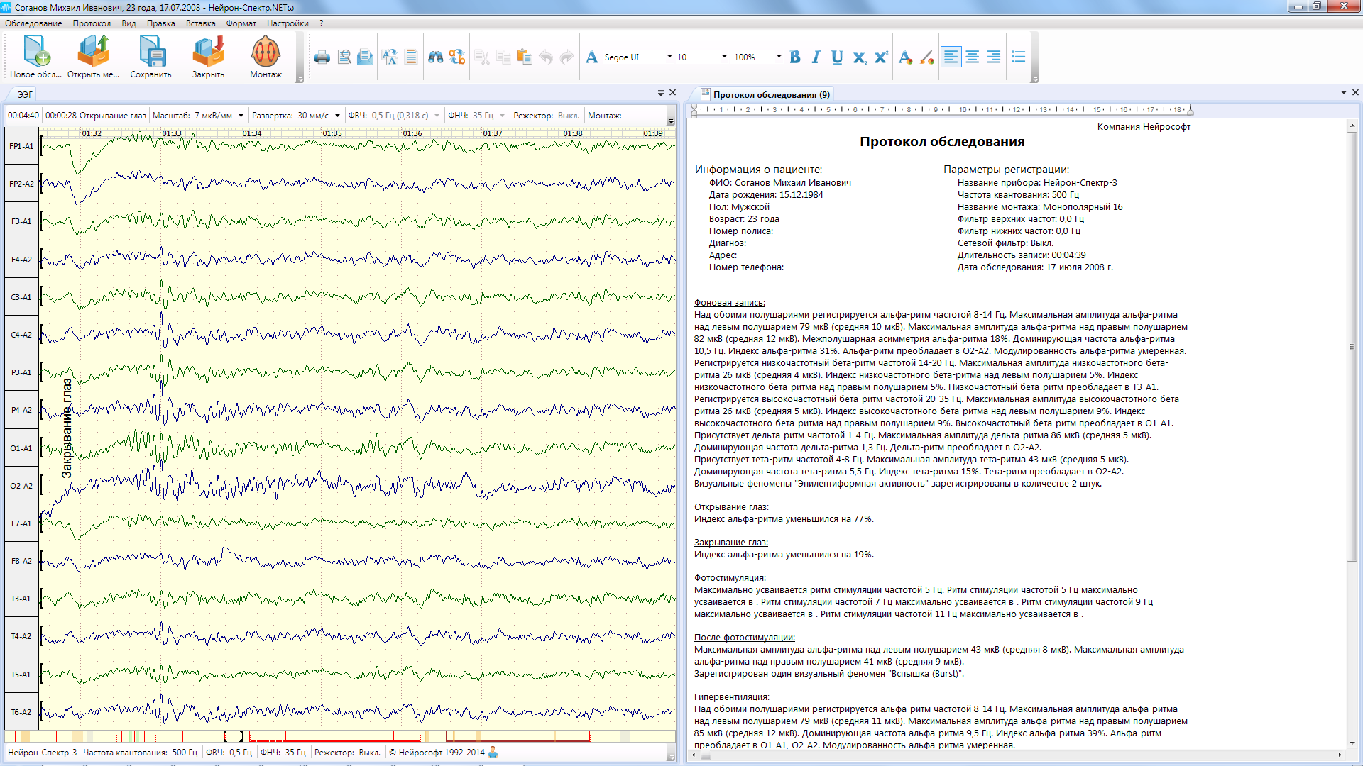 НЕЙРОН-СПЕКТР-4/П - изображение №8