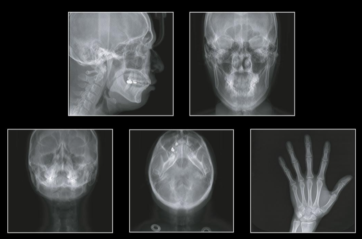 GENORAY Volux с цефалостатом - изображение №7