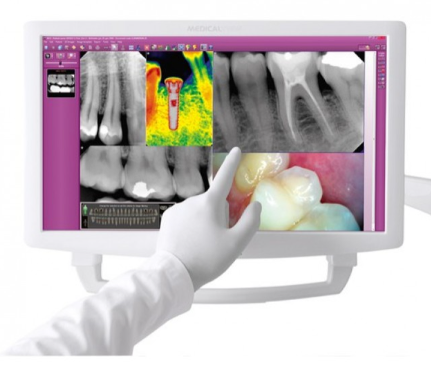 Stern Weber S220 TR Continental - изображение №6