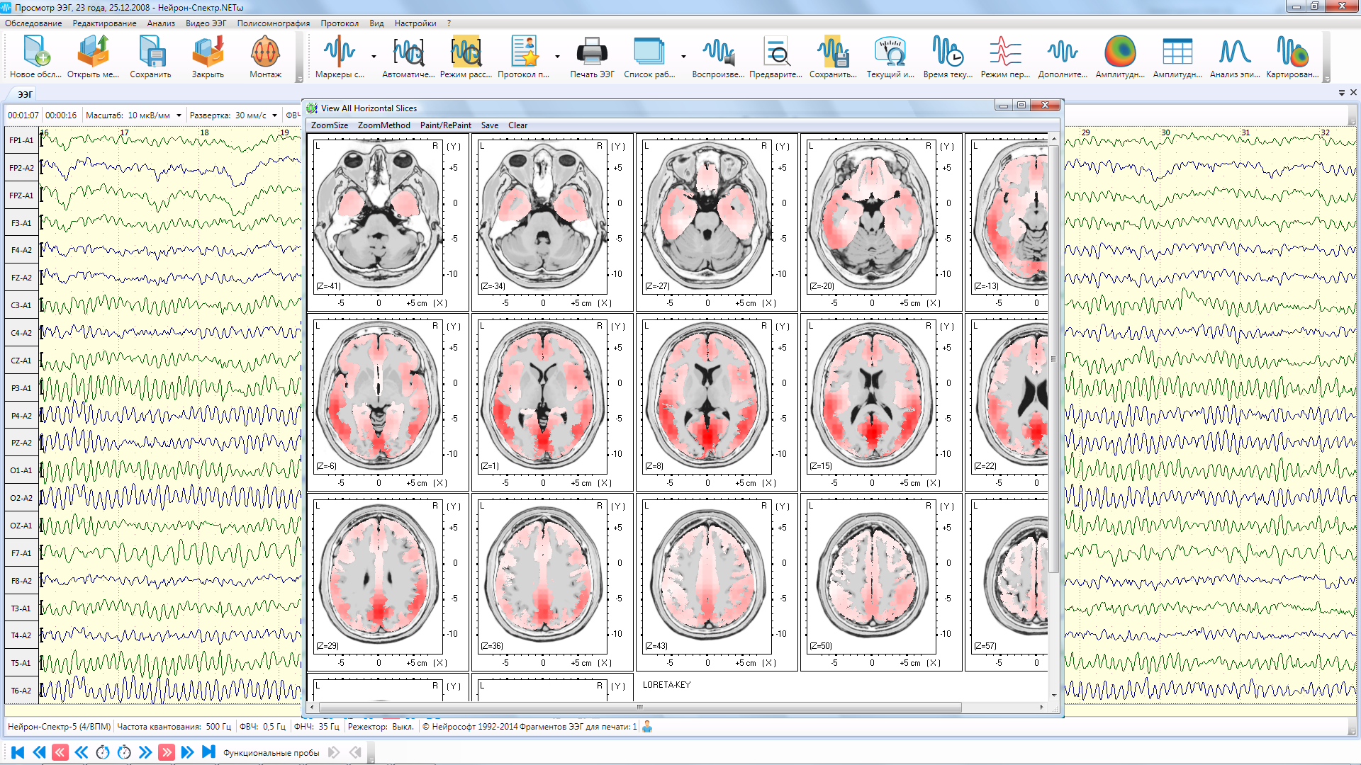 НЕЙРОН-СПЕКТР-5 - изображение №4