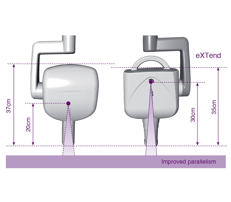 MyRay eXTend - изображение №3