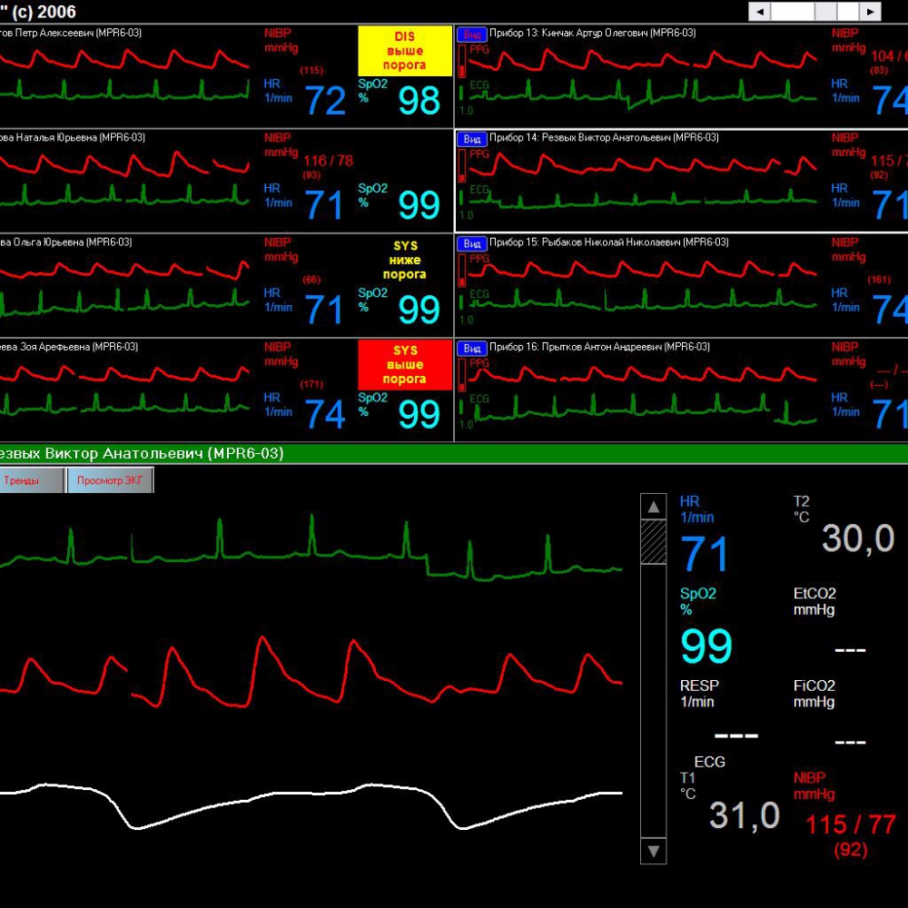 СЦМ1.21 - изображение №2