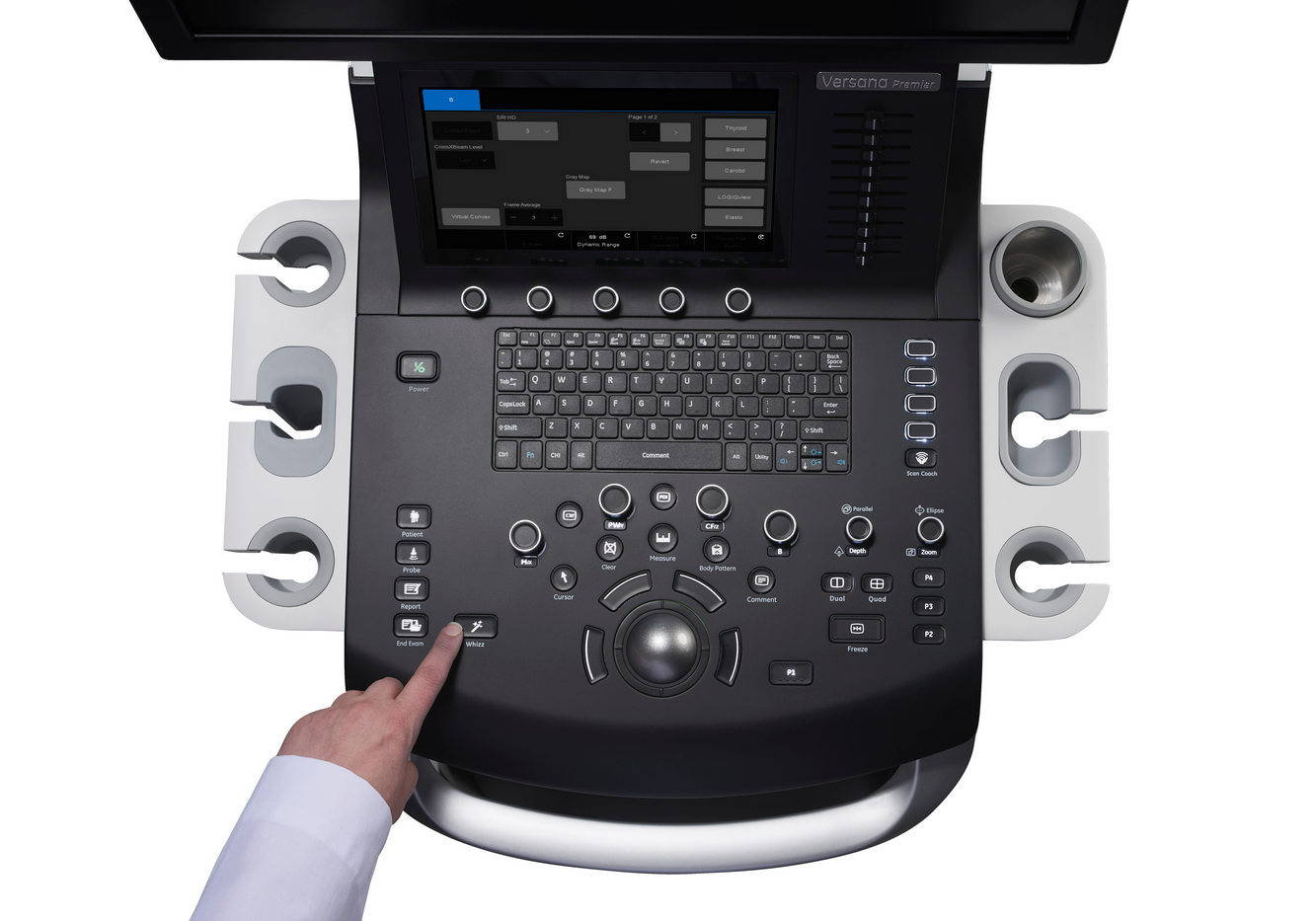 GE Versana Premier Black - изображение №4