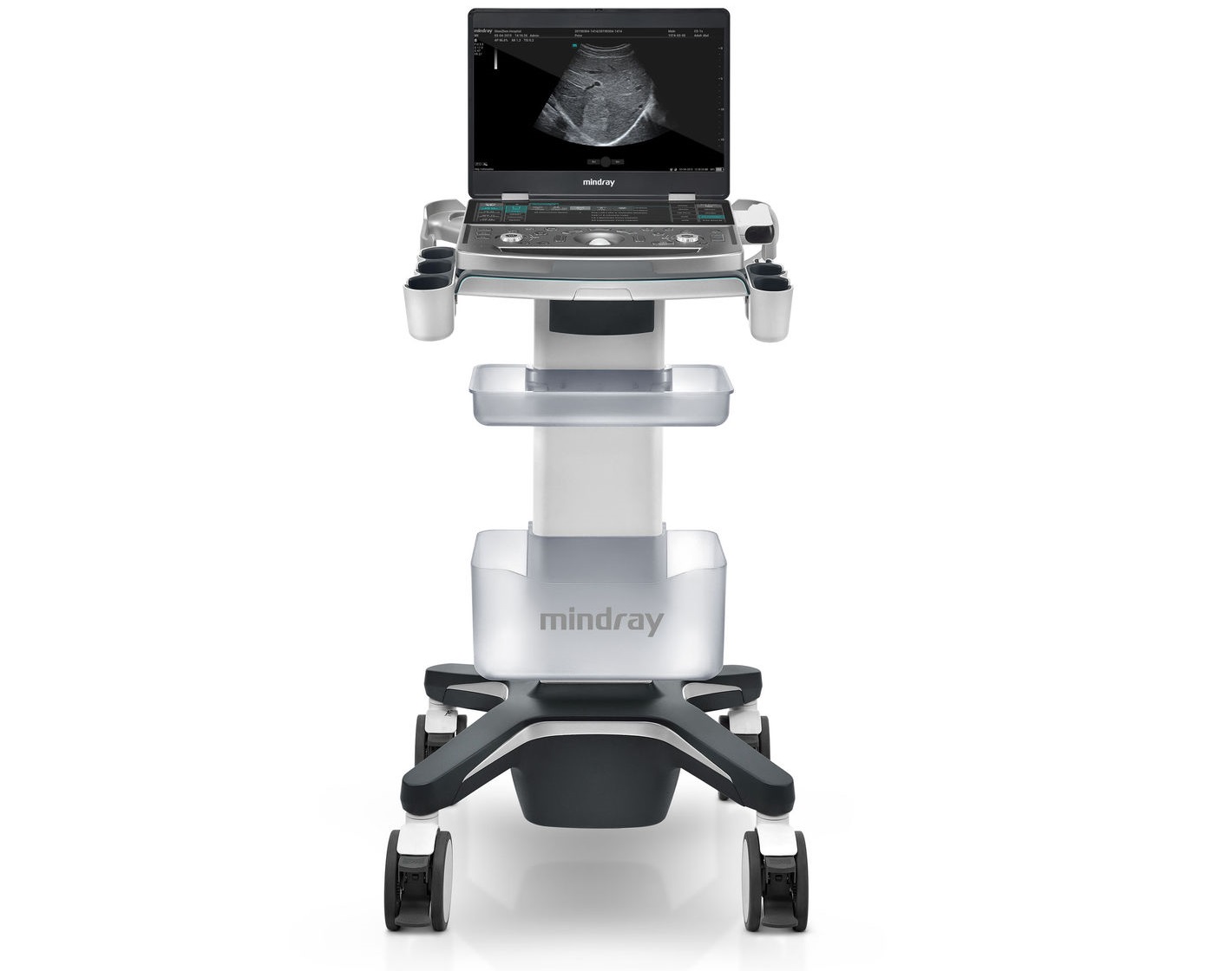 Mindray MX7 - изображение №4