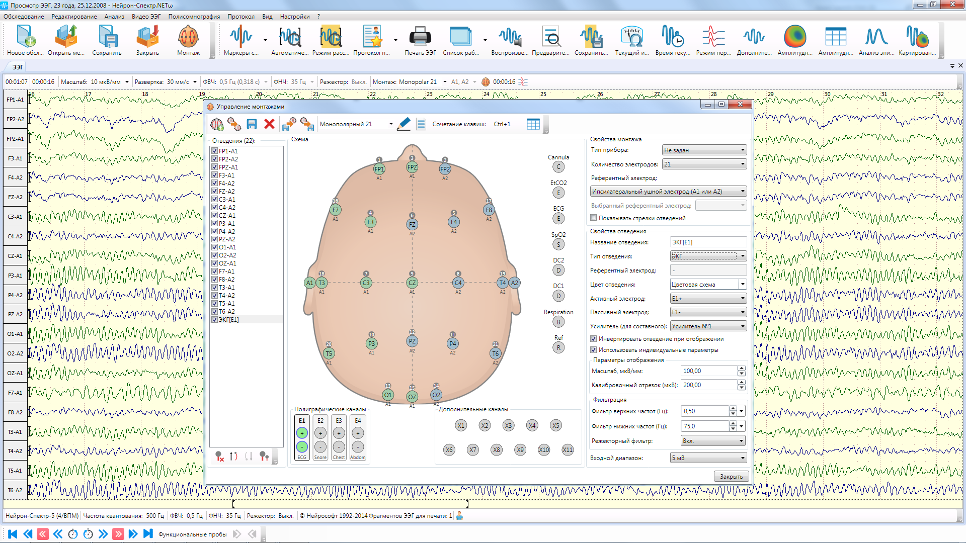 НЕЙРОН-СПЕКТР-3 - изображение №14