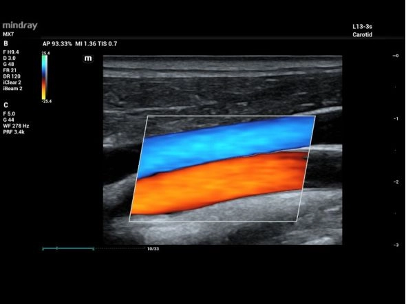 Почесная перфузия