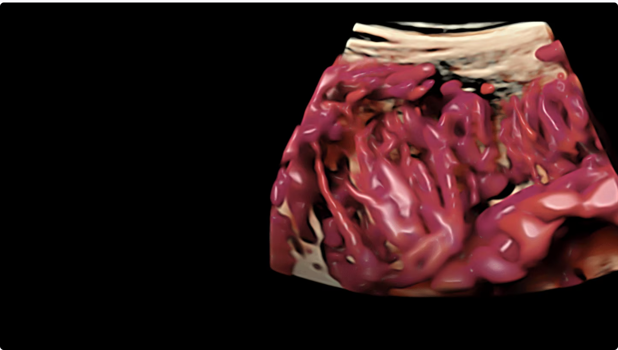 Цветная и допплеровская визцализация