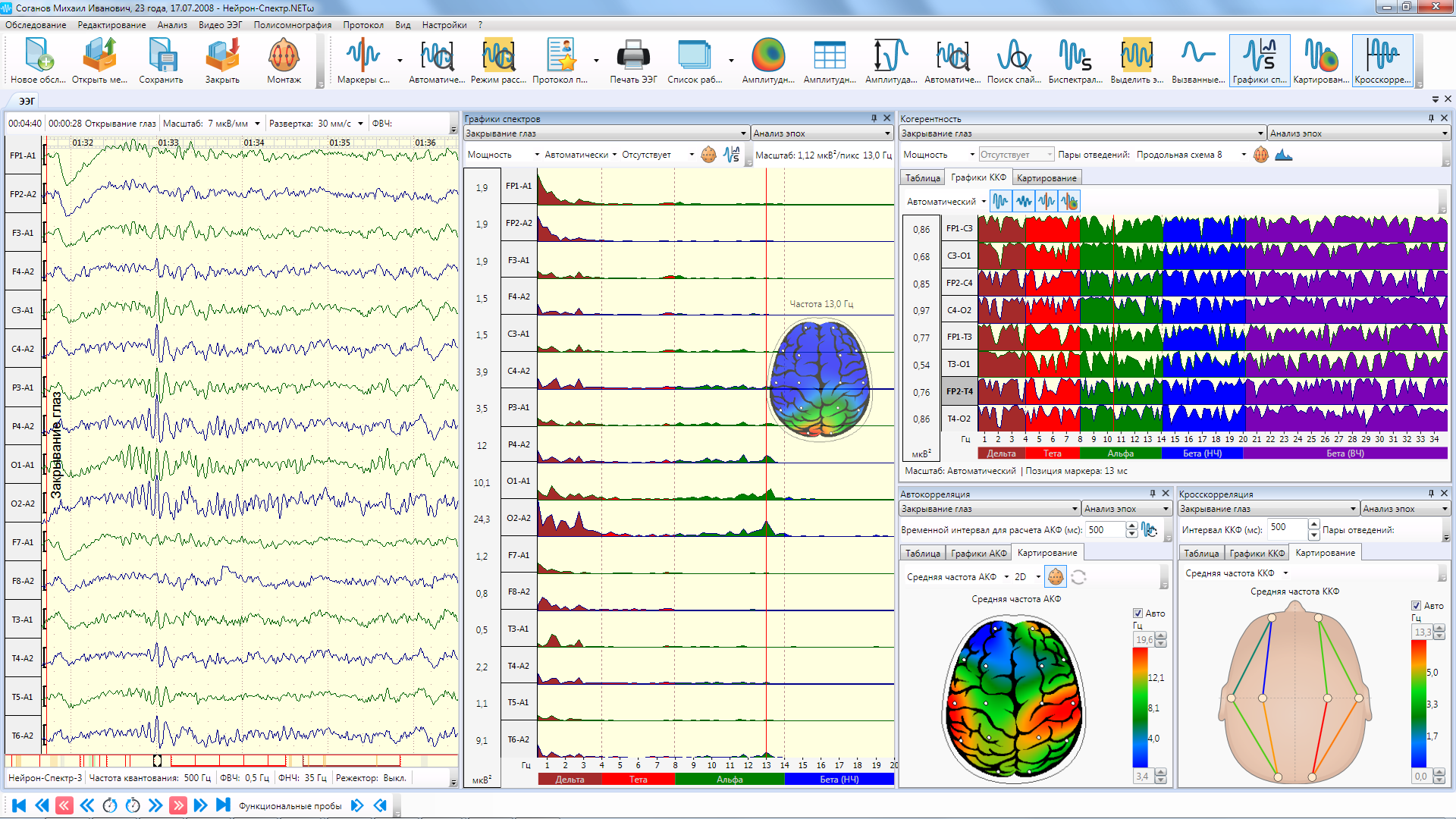 НЕЙРОН-СПЕКТР-4/П - изображение №13