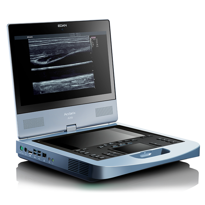 Edan Acclarix AX - изображение №3